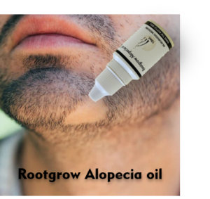 Alopecia Oil