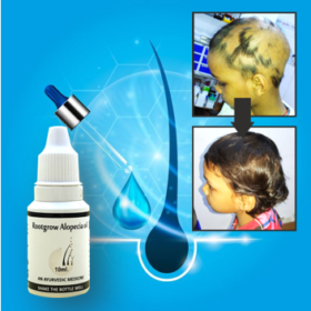 Alopecia Oil | Root Grow | Alopecia & Beard Growth Oil for Men and Women | 20ML